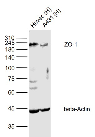 Lane 1: Human HUVEC cell lysates; Lane 2: Human A431 cell lysates probed with ZO-1 Polyclonal Antibody, Unconjugated (bs-1329R) at 1:1000 dilution and 4˚C overnight incubation. Followed by conjugated secondary antibody incubation at 1:20000 for 60 min at 37˚C.