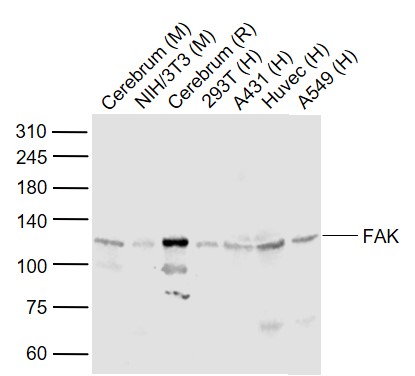 Lane 1: Mouse Cerebrum lysates; Lane 2: Mouse NIH/3T3 cell lysates; Lane 3: Rat Cerebrum lysates; Lane 4: Human 293T cell lysates; Lane 5: Human A431 cell lysates; Lane 6: Human HUVEC cell lysates; Lane 7: Human A549 cell lysates probed with FAK Polyclonal Antibody, Unconjugated (bs-1340R) at 1:1000 dilution and 4˚C overnight incubation. Followed by conjugated secondary antibody incubation at 1:20000 for 60 min at 37˚C.