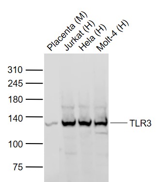 Lane 1: Mouse Placenta lysates; Lane 2: Human Jurkat cell lysates; Lane 3: Human Hela cell lysates; Lane 4: Human MOLT-4 cell lysates probed with TLR3 Polyclonal Antibody, Unconjugated (bs-1444R) at 1:1000 dilution and 4˚C overnight incubation. Followed by conjugated secondary antibody incubation at 1:20000 for 60 min at 37˚C.