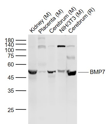 Lane 1: Mouse Kidney lysates; Lane 2: Mouse Placenta lysates; Lane 3: Mouse Cerebrum lysates; Lane 4: Mouse NIH/3T3 cell lysates; Lane 5: Rat Cerebrum lysates probed with BMP7 Polyclonal Antibody, Unconjugated (bs-2242R) at 1:1000 dilution and 4˚C overnight incubation. Followed by conjugated secondary antibody incubation at 1:20000 for 60 min at 37˚C.