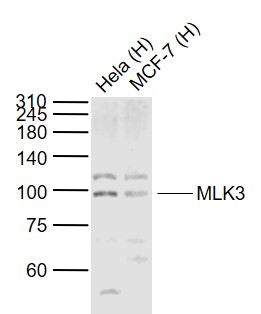 Lane 1: Human Hela cell lysates; Lane 2: Human MCF-7 cell lysates probed with MLK3 Polyclonal Antibody, Unconjugated (bs-2992R) at 1:1000 dilution and 4˚C overnight incubation. Followed by conjugated secondary antibody incubation at 1:20000 for 60 min at 37˚C.