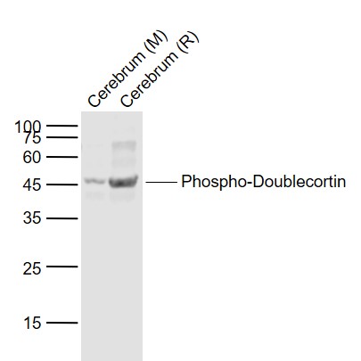 Lane 1: Mouse Cerebrum lysates; Lane 2: Rat Cerebrum lysates probed with Doublecortin (Ser47) Polyclonal Antibody, Unconjugated (bs-3113R) at 1:1000 dilution and 4˚C overnight incubation. Followed by conjugated secondary antibody incubation at 1:20000 for 60 min at 37˚C.