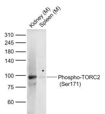 Lane 1: Mouse Kidney lysates; Lane 2: Mouse Spleen lysates probed with TORC2 (Ser171) Polyclonal Antibody, Unconjugated (bs-3415R) at 1:1000 dilution and 4˚C overnight incubation. Followed by conjugated secondary antibody incubation at 1:20000 for 60 min at 37˚C.