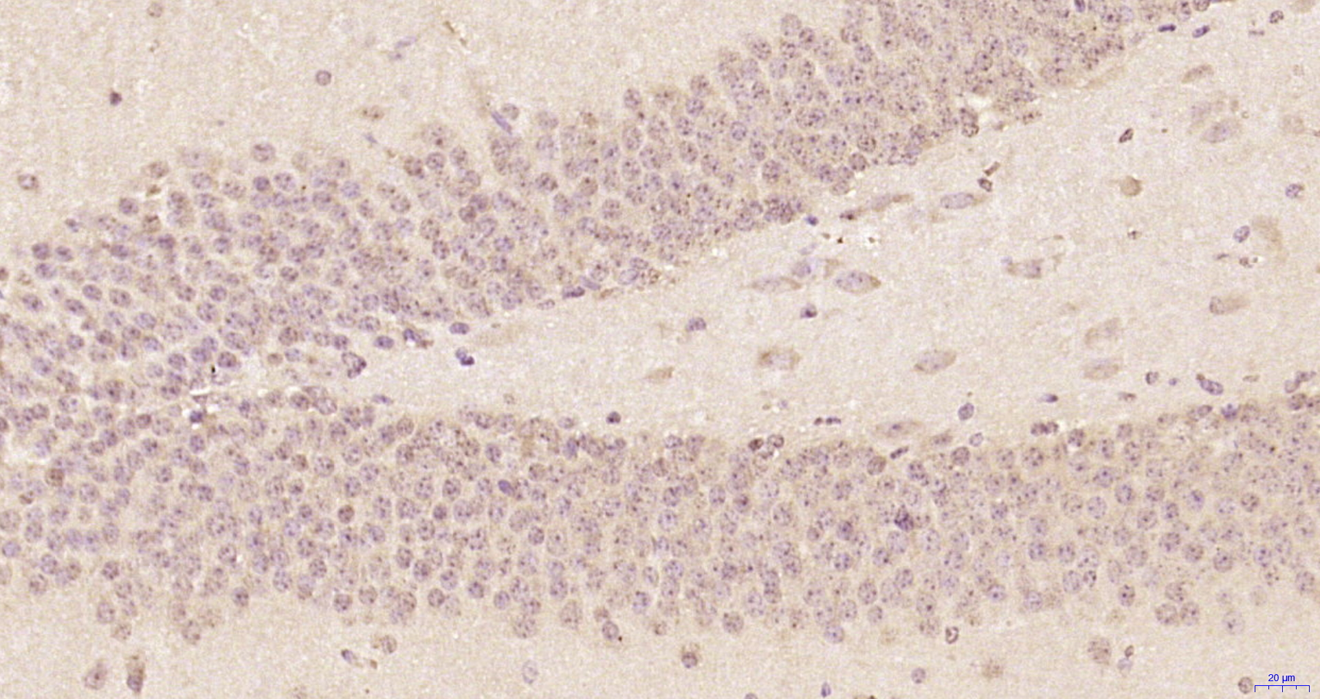 Paraformaldehyde-fixed, paraffin embedded Mouse brain; Antigen retrieval by boiling in sodium citrate buffer (pH6.0) for 15min; Block endogenous peroxidase by 3% hydrogen peroxide for 20 minutes; Blocking buffer (normal goat serum) at 37°C for 30min; Antibody incubation with ZNF775 Polyclonal Antibody, Unconjugated (bs-4382R) at 1:200 overnight at 4°C, DAB staining.