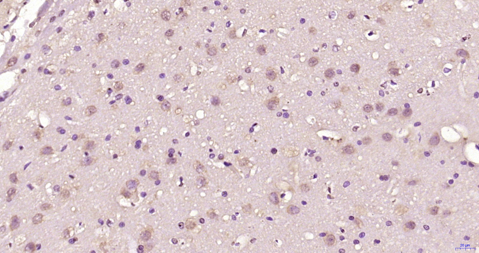 Paraformaldehyde-fixed, paraffin embedded Rat brain; Antigen retrieval by boiling in sodium citrate buffer (pH6.0) for 15min; Block endogenous peroxidase by 3% hydrogen peroxide for 20 minutes; Blocking buffer (normal goat serum) at 37°C for 30min; Antibody incubation with ZNF775 Polyclonal Antibody, Unconjugated (bs-4382R) at 1:200 overnight at 4°C, DAB staining.