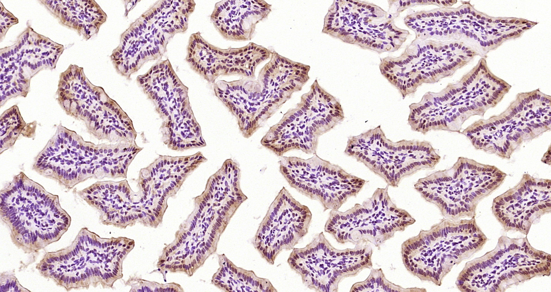 Paraformaldehyde-fixed, paraffin embedded Mouse intestine; Antigen retrieval by boiling in sodium citrate buffer (pH6.0) for 15min; Block endogenous peroxidase by 3% hydrogen peroxide for 20 minutes; Blocking buffer (normal goat serum) at 37°C for 30min; Antibody incubation with PTRHD1 Polyclonal Antibody, Unconjugated (bs-4433R) at 1:200 overnight at 4°C, DAB staining.