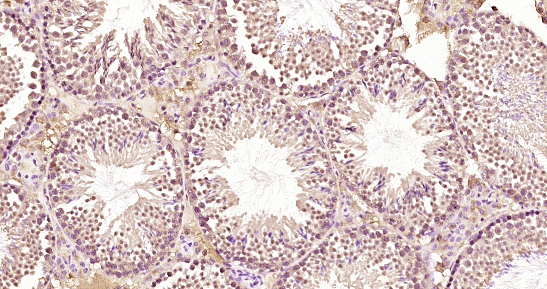 Paraformaldehyde-fixed, paraffin embedded Mouse testis; Antigen retrieval by boiling in sodium citrate buffer (pH6.0) for 15min; Block endogenous peroxidase by 3% hydrogen peroxide for 20 minutes; Blocking buffer (normal goat serum) at 37°C for 30min; Antibody incubation with PTRHD1 Polyclonal Antibody, Unconjugated (bs-4433R) at 1:200 overnight at 4°C, DAB staining.