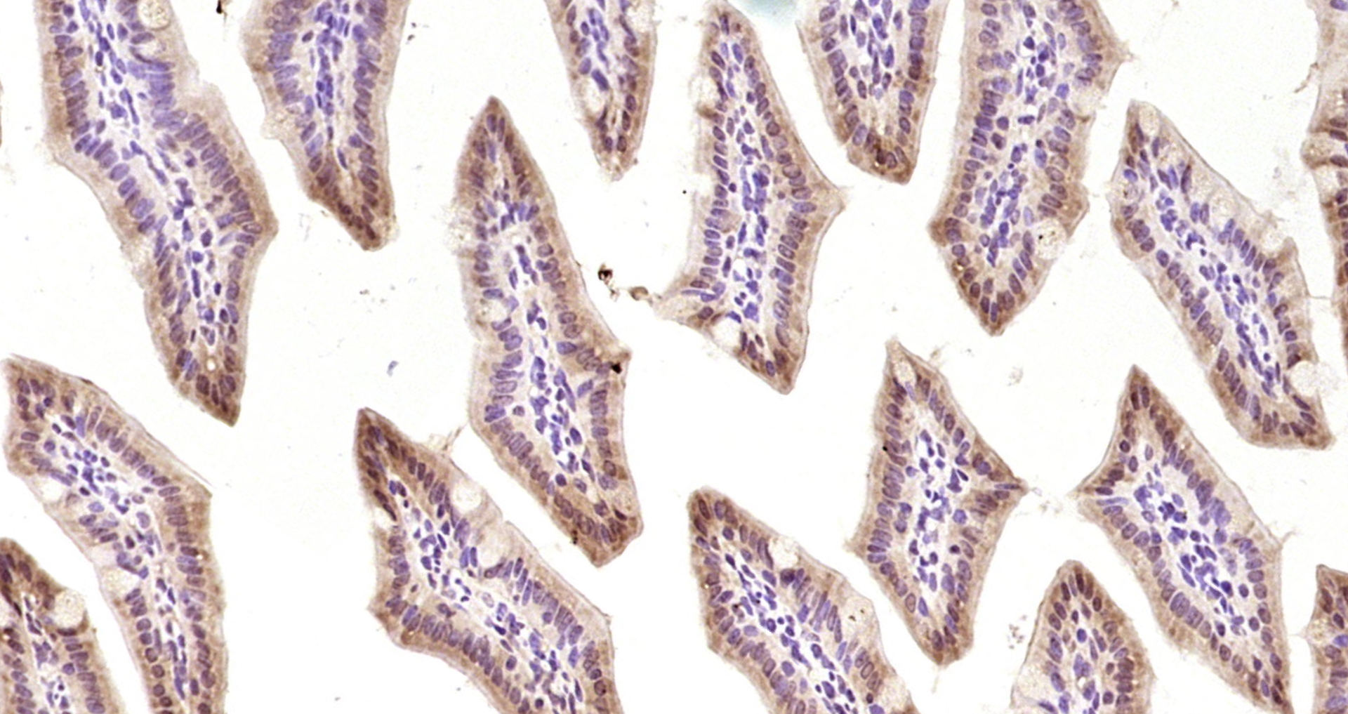 Paraformaldehyde-fixed, paraffin embedded Mouse intestine; Antigen retrieval by boiling in sodium citrate buffer (pH6.0) for 15min; Block endogenous peroxidase by 3% hydrogen peroxide for 20 minutes; Blocking buffer (normal goat serum) at 37°C for 30min; Antibody incubation with PER-3 Polyclonal Antibody, Unconjugated (bs-4498R) at 1:200 overnight at 4°C, DAB staining.