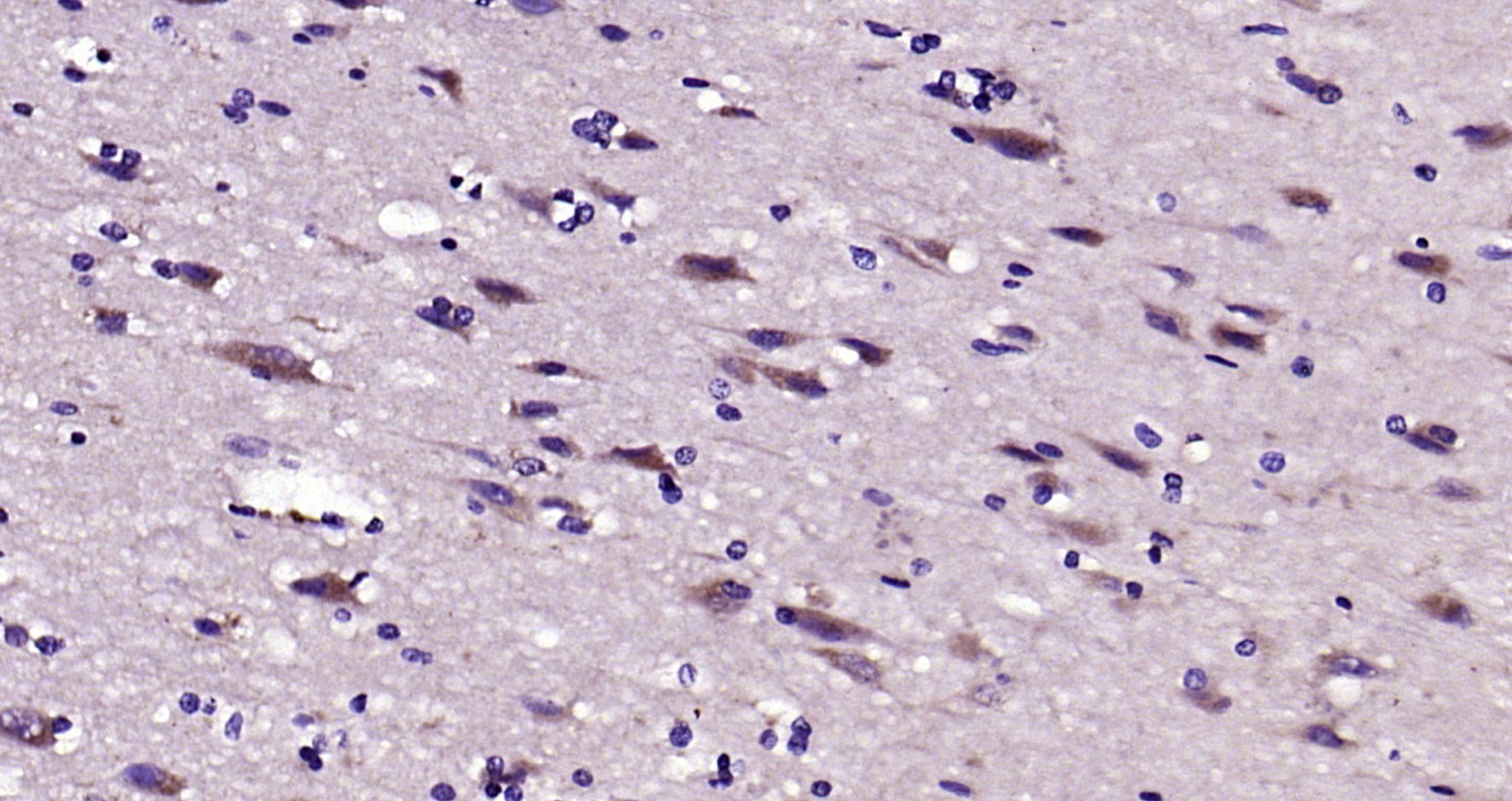 Paraformaldehyde-fixed, paraffin embedded Human brain; Antigen retrieval by boiling in sodium citrate buffer (pH6.0) for 15min; Block endogenous peroxidase by 3% hydrogen peroxide for 20 minutes; Blocking buffer (normal goat serum) at 37°C for 30min; Antibody incubation with LRP1 Polyclonal Antibody, Unconjugated (bs-10920R) at 1:200 overnight at 4°C, DAB staining.