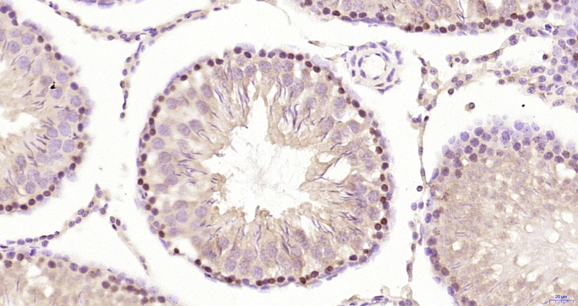 Paraformaldehyde-fixed, paraffin embedded Rat testis; Antigen retrieval by boiling in sodium citrate buffer (pH6.0) for 15min; Block endogenous peroxidase by 3% hydrogen peroxide for 20 minutes; Blocking buffer (normal goat serum) at 37°C for 30min; Antibody incubation with RNF111 Polyclonal Antibody, Unconjugated (bs-10937R) at 1:200 overnight at 4°C, DAB staining.