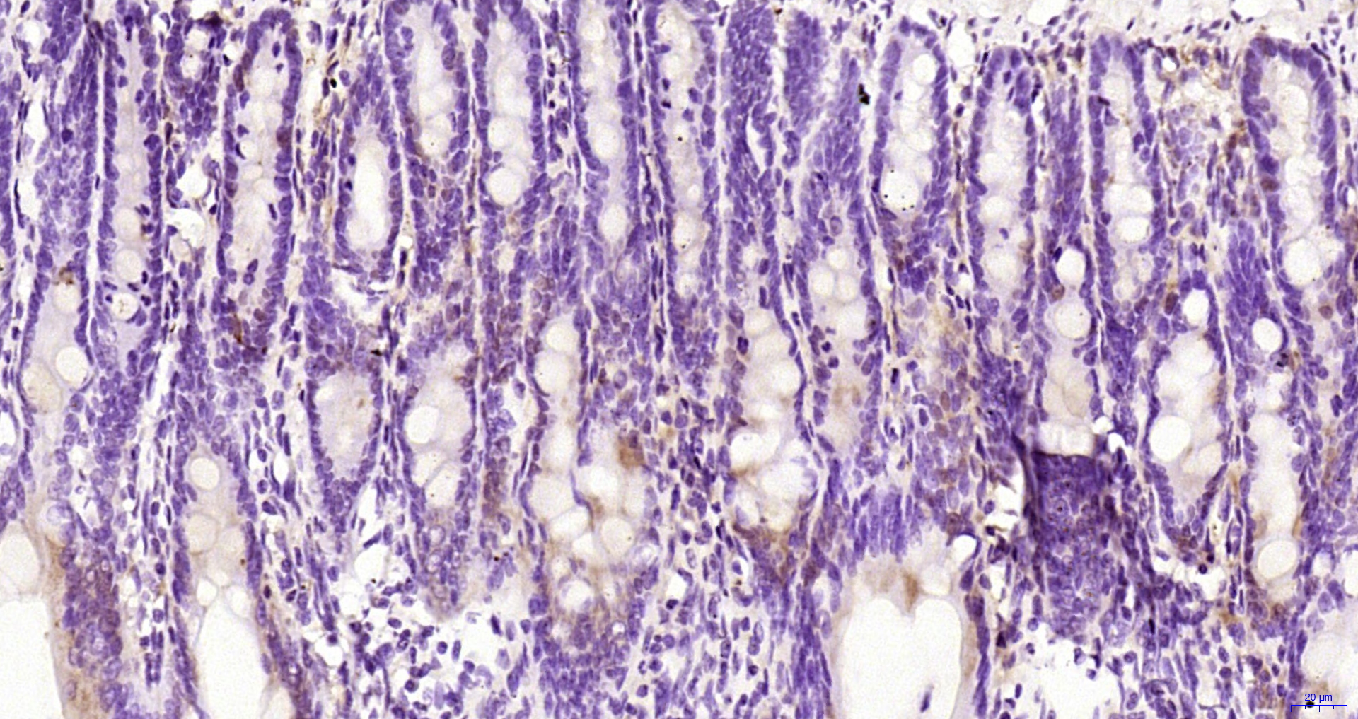 Paraformaldehyde-fixed, paraffin embedded Rat colon; Antigen retrieval by boiling in sodium citrate buffer (pH6.0) for 15min; Block endogenous peroxidase by 3% hydrogen peroxide for 20 minutes; Blocking buffer (normal goat serum) at 37°C for 30min; Antibody incubation with RNF111 Polyclonal Antibody, Unconjugated (bs-10937R) at 1:200 overnight at 4°C, DAB staining.