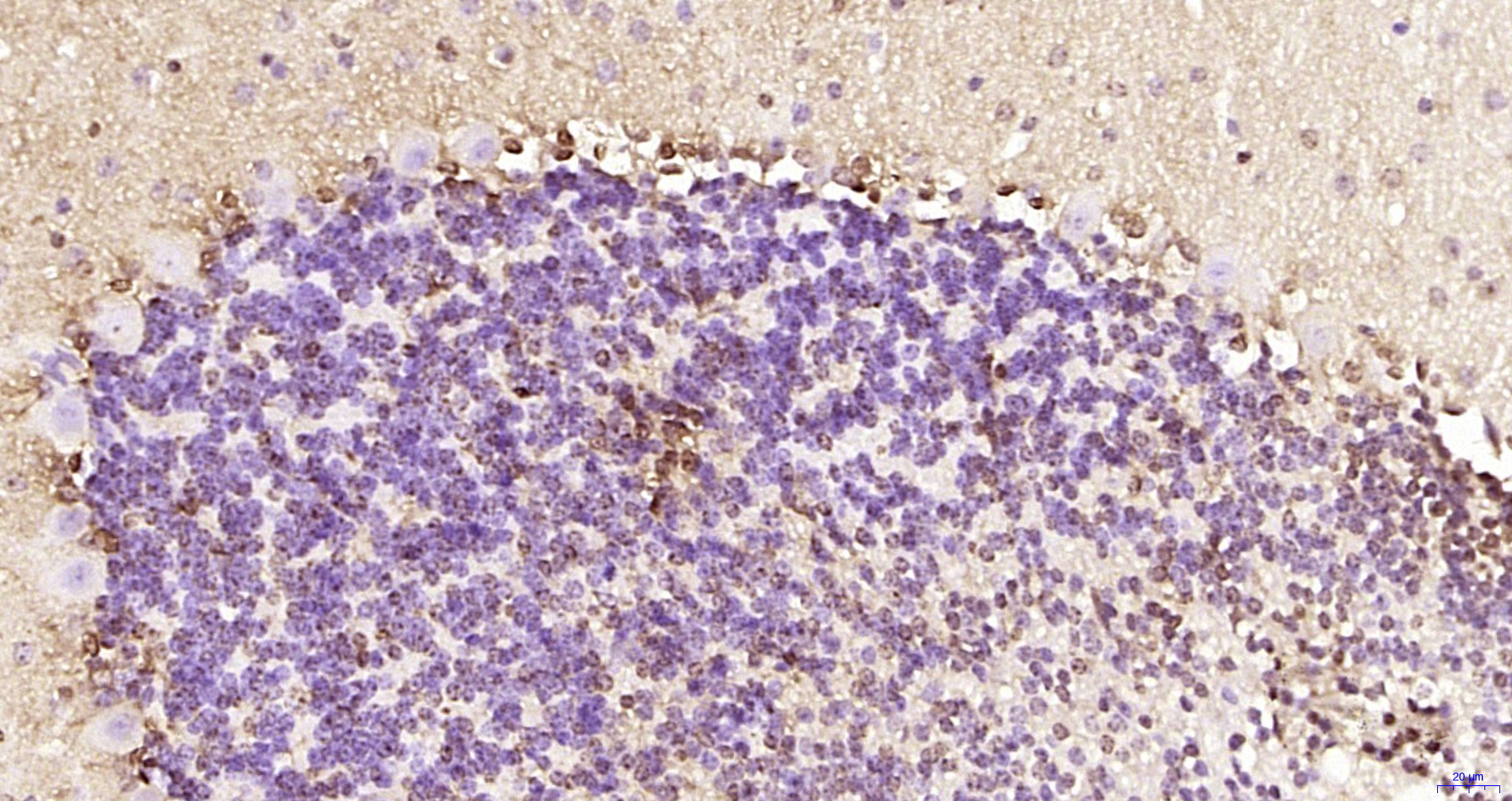 Paraformaldehyde-fixed, paraffin embedded Mouse cerebellum; Antigen retrieval by boiling in sodium citrate buffer (pH6.0) for 15min; Block endogenous peroxidase by 3% hydrogen peroxide for 20 minutes; Blocking buffer (normal goat serum) at 37°C for 30min; Antibody incubation with RNF111 Polyclonal Antibody, Unconjugated (bs-10937R) at 1:200 overnight at 4°C, DAB staining.