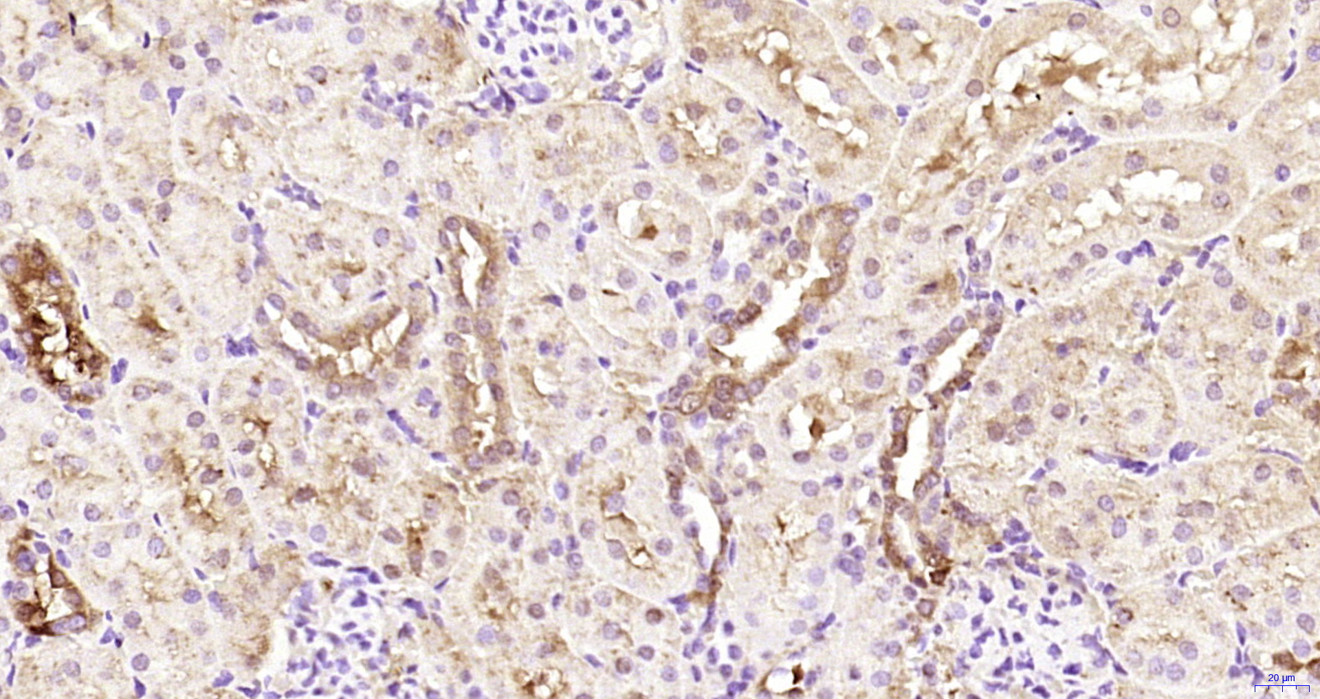 Paraformaldehyde-fixed, paraffin embedded Rat kidney; Antigen retrieval by boiling in sodium citrate buffer (pH6.0) for 15min; Block endogenous peroxidase by 3% hydrogen peroxide for 20 minutes; Blocking buffer (normal goat serum) at 37°C for 30min; Antibody incubation with EDC4 Polyclonal Antibody, Unconjugated (bs-10953R) at 1:200 overnight at 4°C, DAB staining.