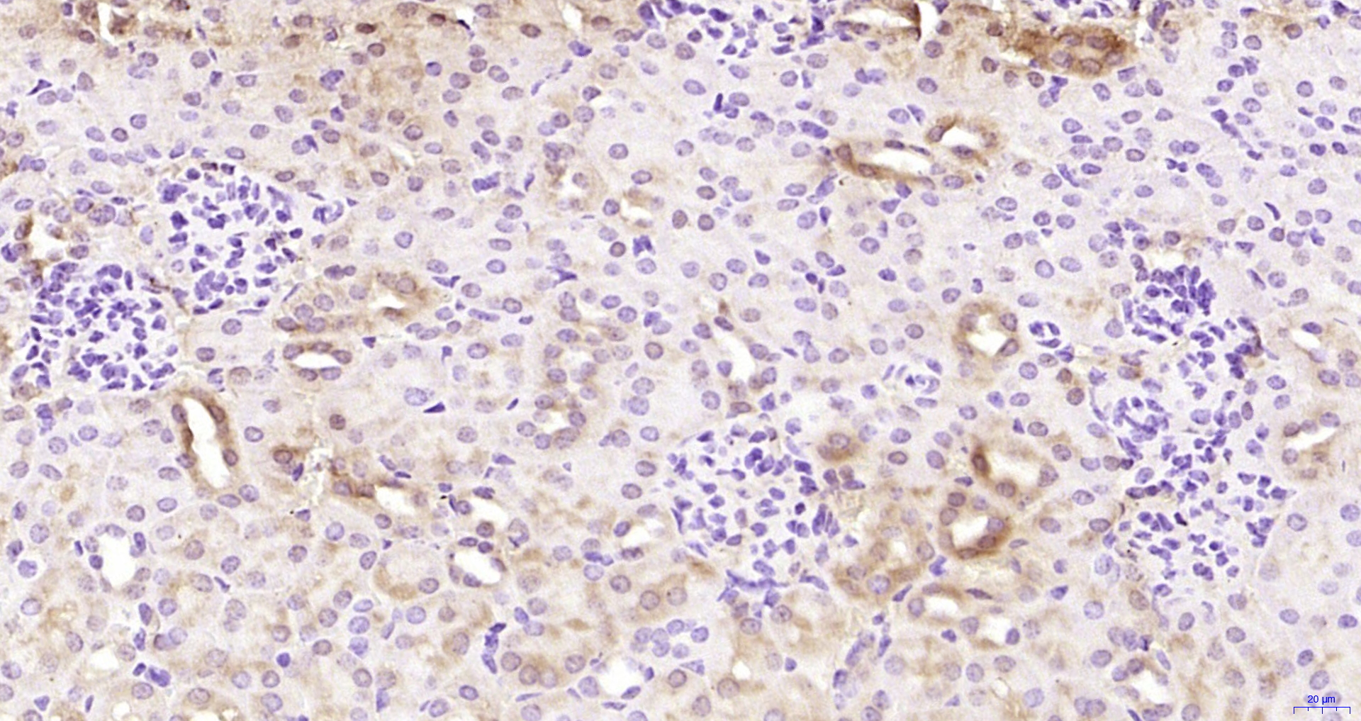 Paraformaldehyde-fixed, paraffin embedded Mouse kidney; Antigen retrieval by boiling in sodium citrate buffer (pH6.0) for 15min; Block endogenous peroxidase by 3% hydrogen peroxide for 20 minutes; Blocking buffer (normal goat serum) at 37°C for 30min; Antibody incubation with EDC4 Polyclonal Antibody, Unconjugated (bs-10953R) at 1:200 overnight at 4°C, DAB staining.