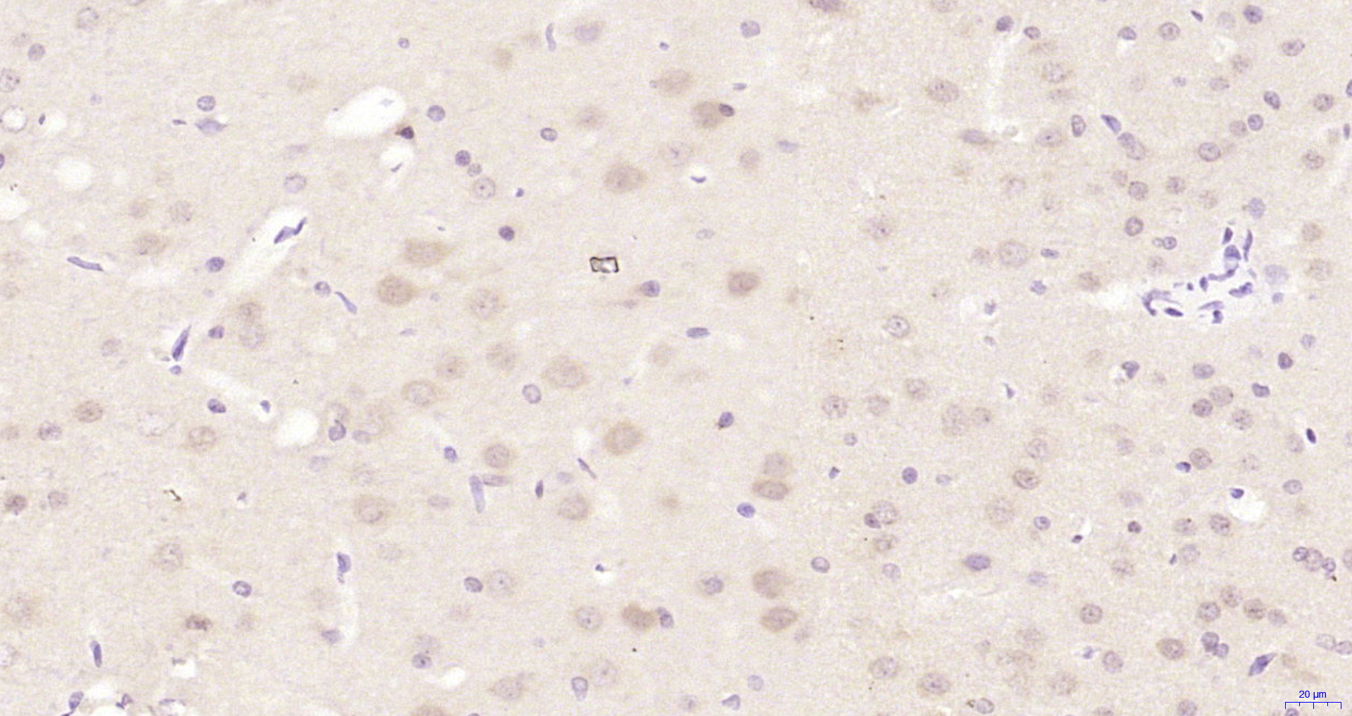 Paraformaldehyde-fixed, paraffin embedded Rat brain; Antigen retrieval by boiling in sodium citrate buffer (pH6.0) for 15min; Block endogenous peroxidase by 3% hydrogen peroxide for 20 minutes; Blocking buffer (normal goat serum) at 37°C for 30min; Antibody incubation with FOXP4 Polyclonal Antibody, Unconjugated (bs-10990R) at 1:200 overnight at 4°C, DAB staining.