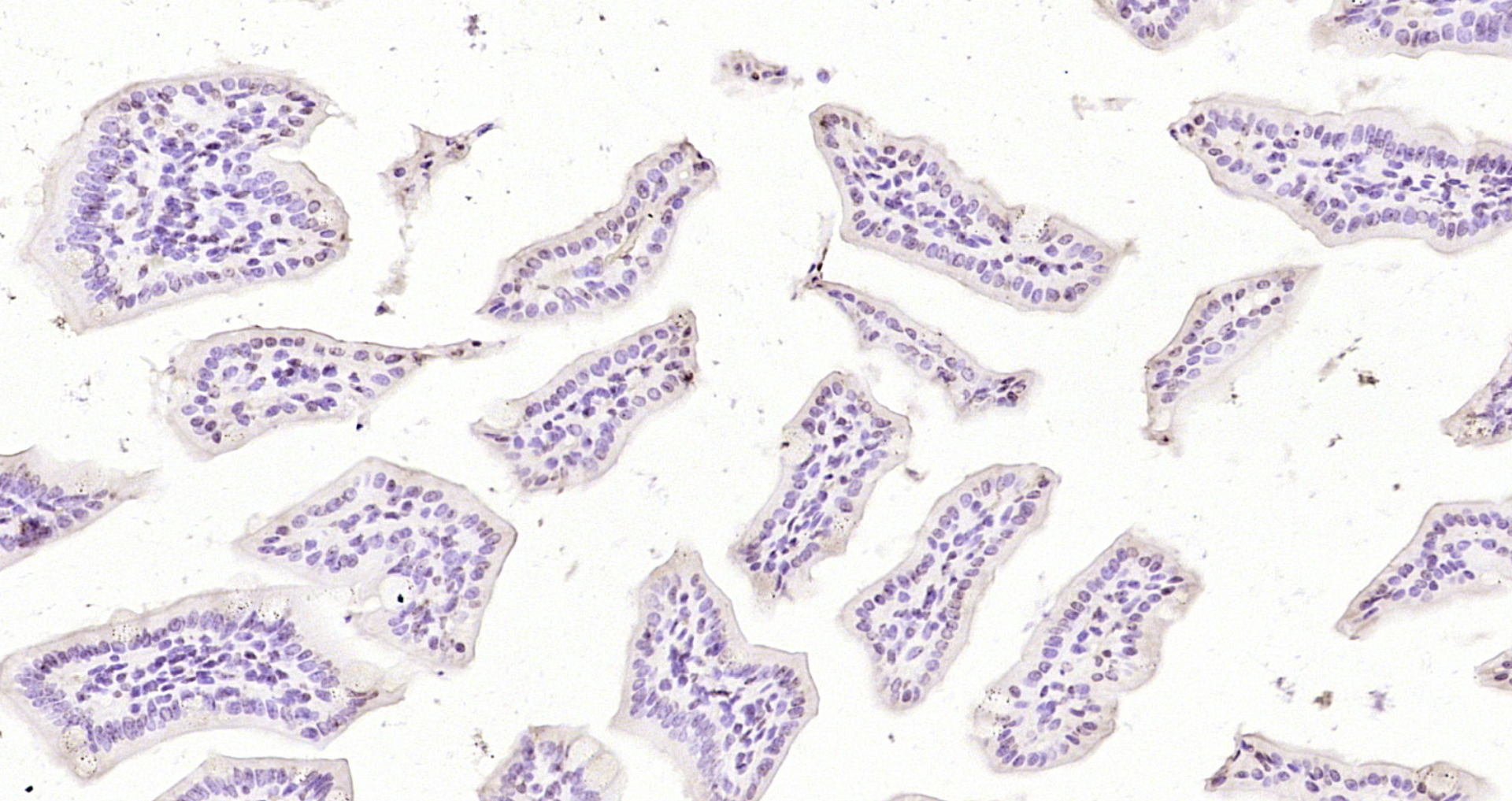 Paraformaldehyde-fixed, paraffin embedded Mouse intestine; Antigen retrieval by boiling in sodium citrate buffer (pH6.0) for 15min; Block endogenous peroxidase by 3% hydrogen peroxide for 20 minutes; Blocking buffer (normal goat serum) at 37°C for 30min; Antibody incubation with EAN57 Polyclonal Antibody, Unconjugated (bs-14481R) at 1:200 overnight at 4°C, DAB staining.