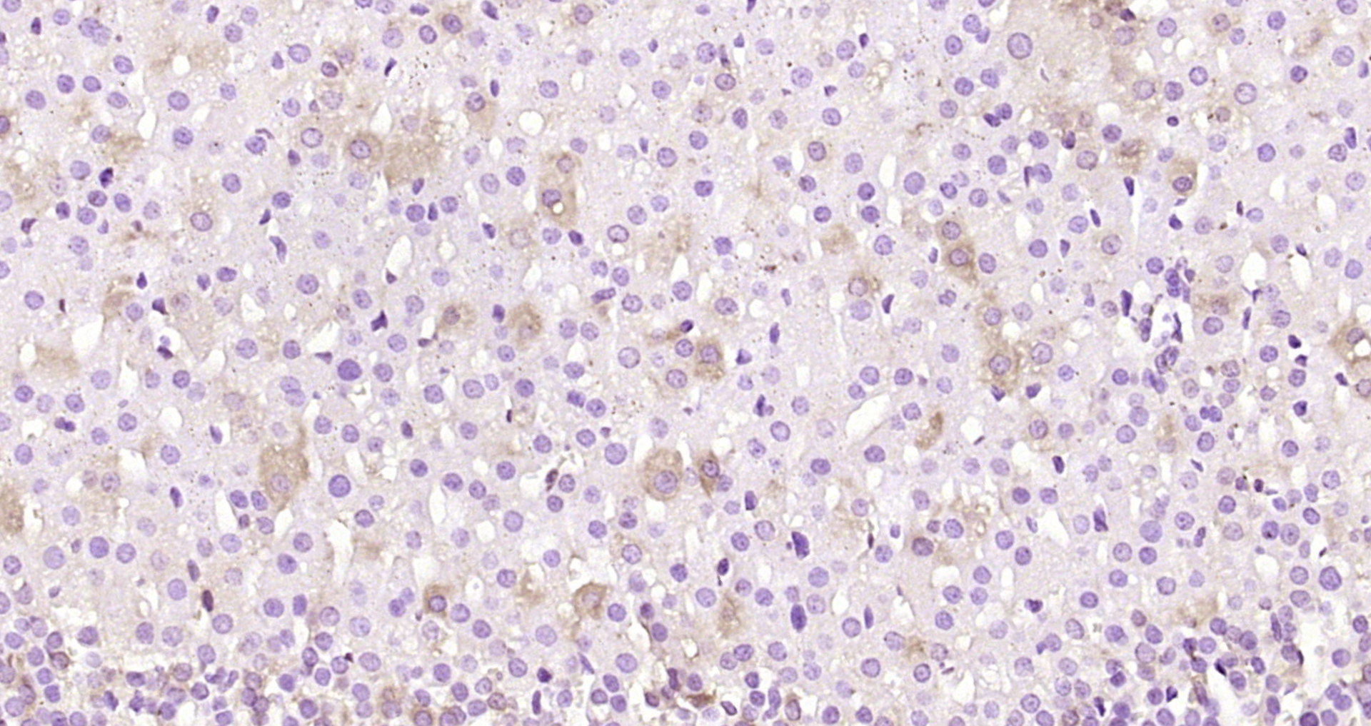 Paraformaldehyde-fixed, paraffin embedded Rat adrenal gland; Antigen retrieval by boiling in sodium citrate buffer (pH6.0) for 15min; Block endogenous peroxidase by 3% hydrogen peroxide for 20 minutes; Blocking buffer (normal goat serum) at 37°C for 30min; Antibody incubation with FAM198B Polyclonal Antibody, Unconjugated (bs-14777R) at 1:200 overnight at 4°C, DAB staining.