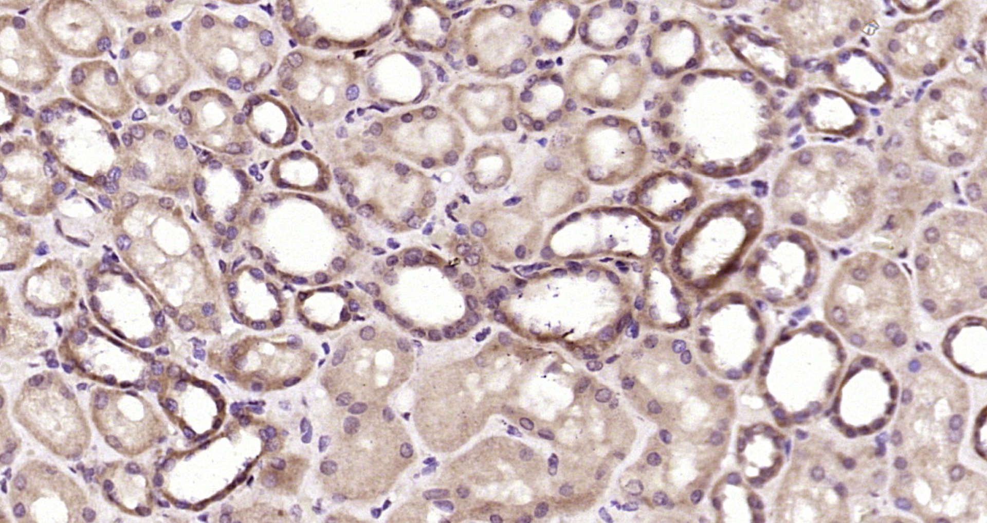 Paraformaldehyde-fixed, paraffin embedded Human kidney; Antigen retrieval by boiling in sodium citrate buffer (pH6.0) for 15min; Block endogenous peroxidase by 3% hydrogen peroxide for 20 minutes; Blocking buffer (normal goat serum) at 37°C for 30min; Antibody incubation with OSBPL9 Polyclonal Antibody, Unconjugated (bs-17522R) at 1:200 overnight at 4°C, DAB staining.