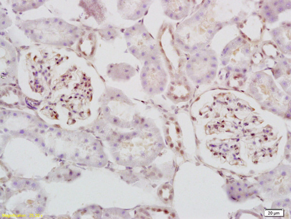 Formalin-fixed and paraffin embedded rat kidney labeled with Anti STK3/MST3 Polyclonal Antibody, Unconjugated (bs-7599R) at 1:200 followed by conjugation to the secondary antibody and DAB staining