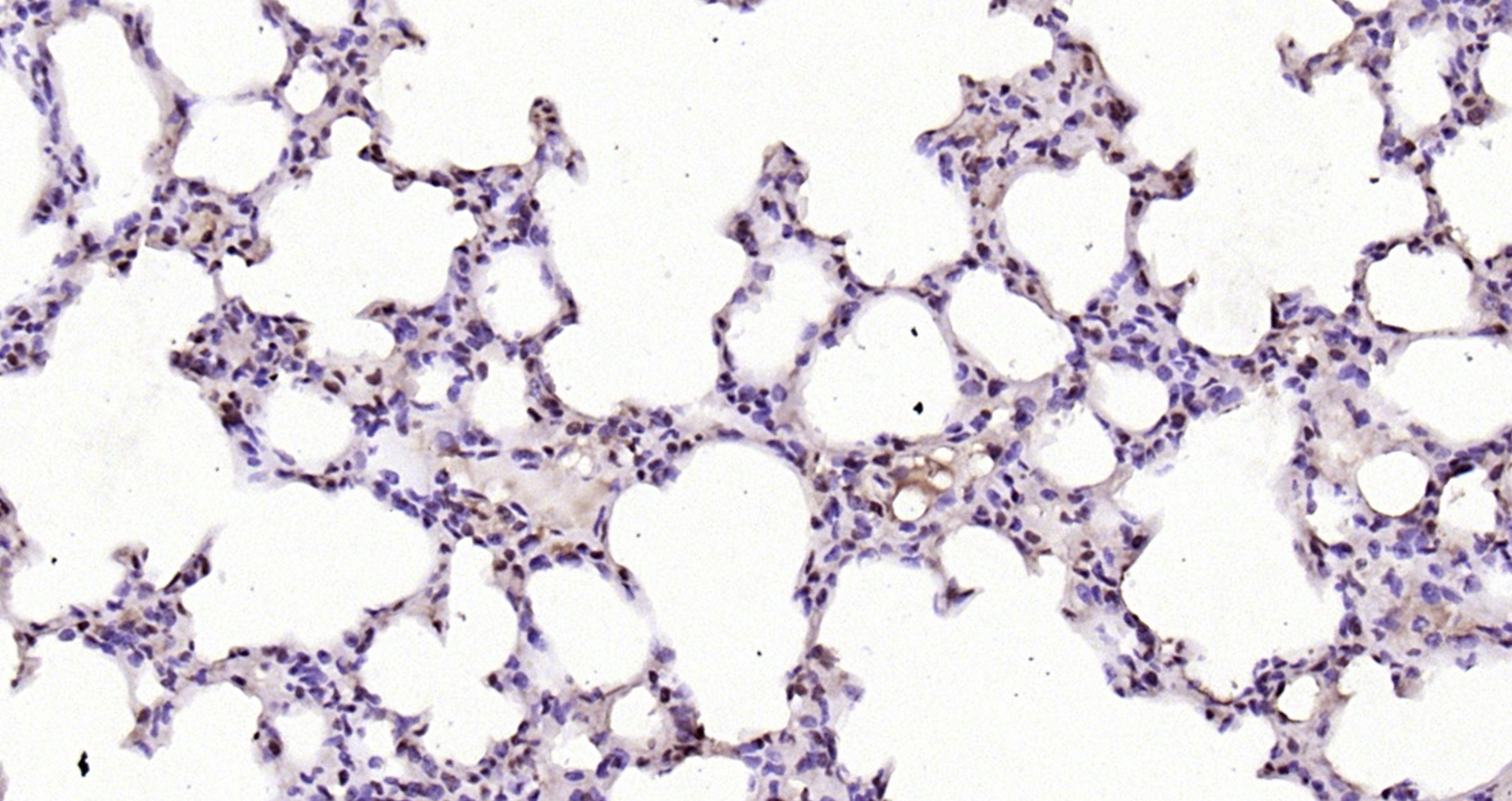 Paraformaldehyde-fixed, paraffin embedded Rat lung; Antigen retrieval by boiling in sodium citrate buffer (pH6.0) for 15min; Block endogenous peroxidase by 3% hydrogen peroxide for 20 minutes; Blocking buffer (normal goat serum) at 37°C for 30min; Antibody incubation with FAM13C1 Polyclonal Antibody, Unconjugated (bs-8215R) at 1:200 overnight at 4°C, DAB staining.