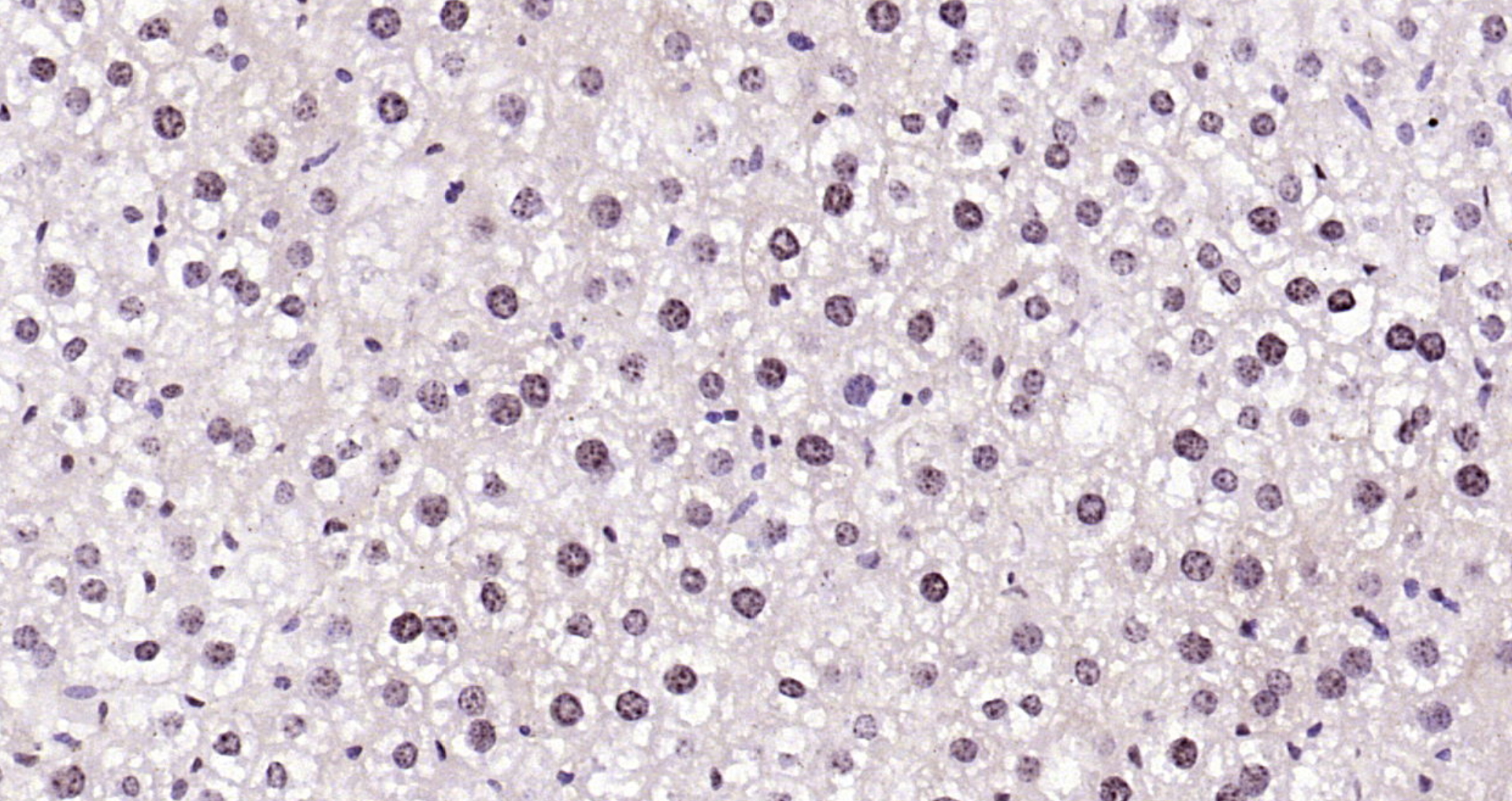 Paraformaldehyde-fixed, paraffin embedded Mouse liver; Antigen retrieval by boiling in sodium citrate buffer (pH6.0) for 15min; Block endogenous peroxidase by 3% hydrogen peroxide for 20 minutes; Blocking buffer (normal goat serum) at 37°C for 30min; Antibody incubation with FAM13C1 Polyclonal Antibody, Unconjugated (bs-8215R) at 1:200 overnight at 4°C, DAB staining.