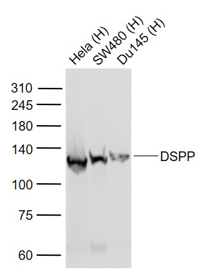 Lane 1: Human Hela cell lysates; Lane 2: Human SW480 cell lysates; Lane 3: Human DU145 cell lysates probed with DSPP Polyclonal Antibody, Unconjugated (bs-10316R) at 1:1000 dilution and 4˚C overnight incubation. Followed by conjugated secondary antibody incubation at 1:20000 for 60 min at 37˚C.