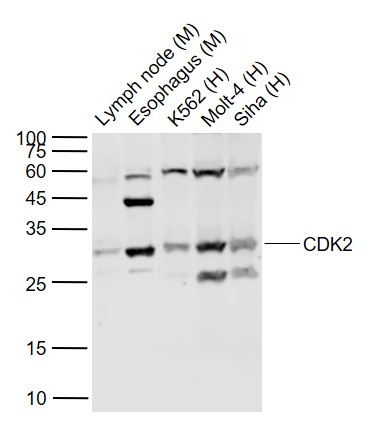 Lane 1: Mouse Lymph node lysates; Lane 2: Mouse Esophagus lysates; Lane 3: Human K562 cell lysates; Lane 4: Human MOLT-4 cell lysates; Lane 5: Human Siha cell lysates probed with CDK2 Polyclonal Antibody, Unconjugated (bs-10726R) at 1:1000 dilution and 4˚C overnight incubation. Followed by conjugated secondary antibody incubation at 1:20000 for 60 min at 37˚C.
