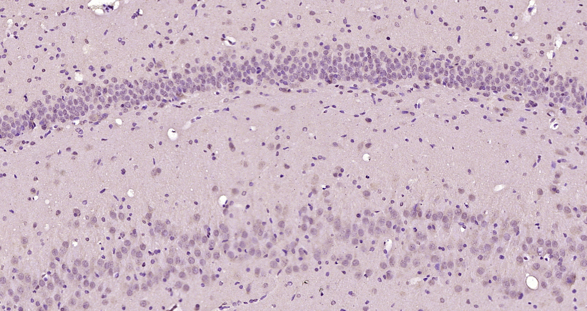 Paraformaldehyde-fixed, paraffin embedded Rat brain; Antigen retrieval by boiling in sodium citrate buffer (pH6.0) for 15min; Block endogenous peroxidase by 3% hydrogen peroxide for 20 minutes; Blocking buffer (normal goat serum) at 37°C for 30min; Antibody incubation with MSGN1 Polyclonal Antibody, Unconjugated (bs-17848R) at 1:200 overnight at 4°C, DAB staining.