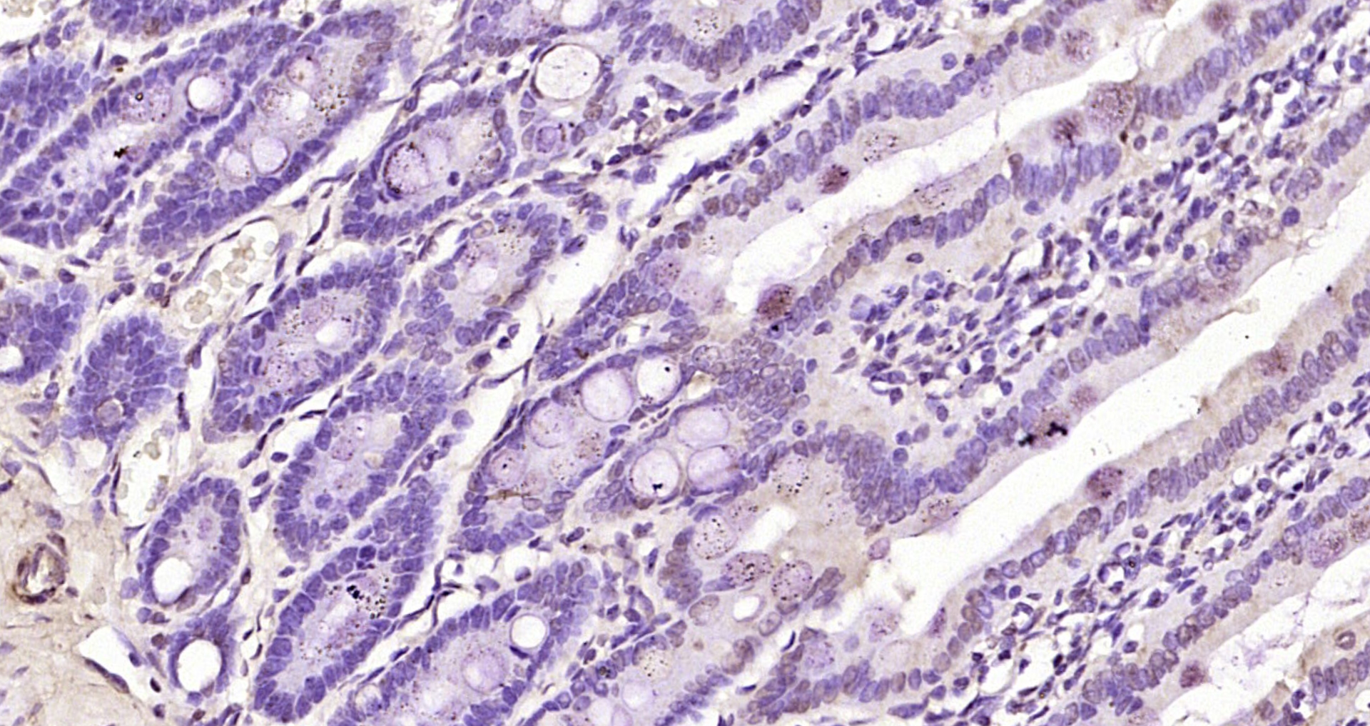 Paraformaldehyde-fixed, paraffin embedded Rat intestine; Antigen retrieval by boiling in sodium citrate buffer (pH6.0) for 15min; Block endogenous peroxidase by 3% hydrogen peroxide for 20 minutes; Blocking buffer (normal goat serum) at 37°C for 30min; Antibody incubation with MSGN1 Polyclonal Antibody, Unconjugated (bs-17848R) at 1:200 overnight at 4°C, DAB staining.