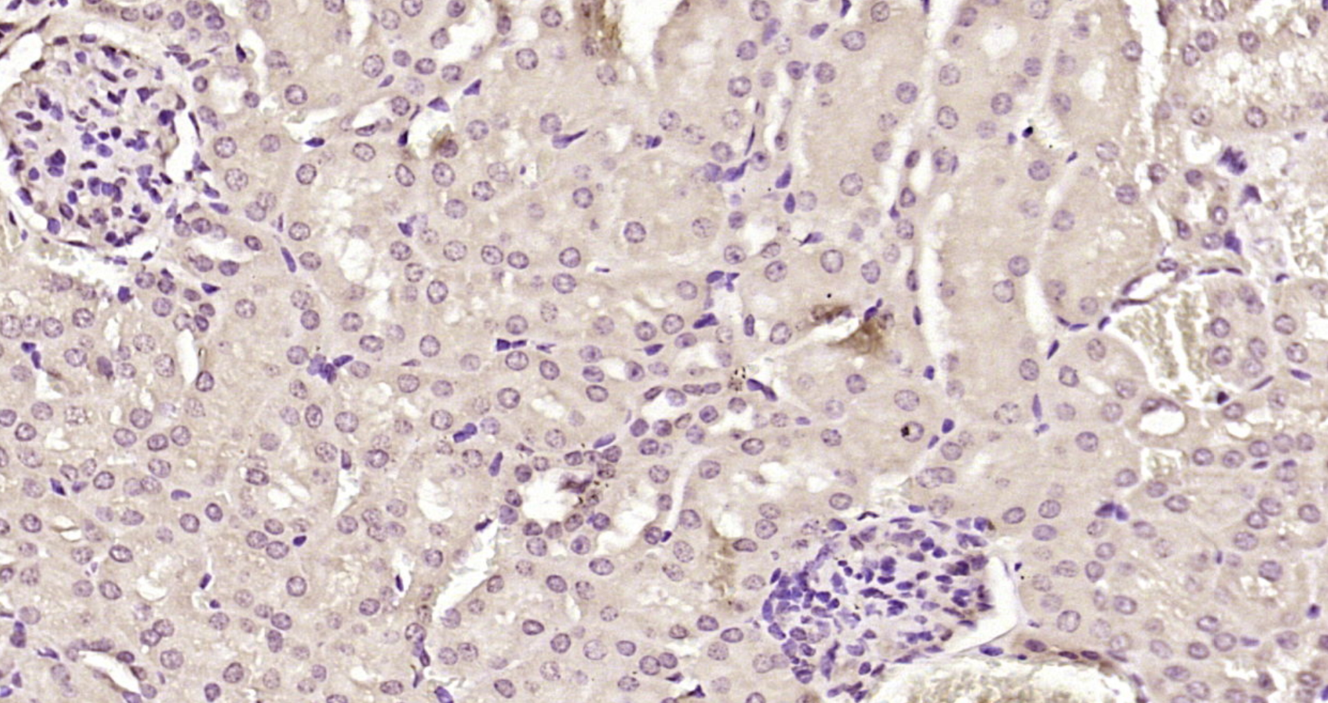Paraformaldehyde-fixed, paraffin embedded Mouse kidney; Antigen retrieval by boiling in sodium citrate buffer (pH6.0) for 15min; Block endogenous peroxidase by 3% hydrogen peroxide for 20 minutes; Blocking buffer (normal goat serum) at 37°C for 30min; Antibody incubation with ORC2 Polyclonal Antibody, Unconjugated (bs-18022R) at 1:200 overnight at 4°C, DAB staining.