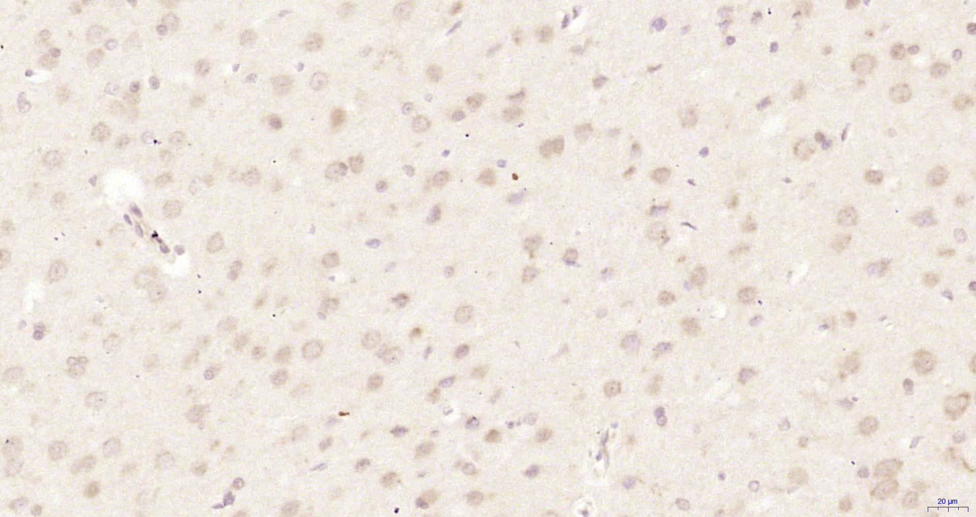 Paraformaldehyde-fixed, paraffin embedded Rat brain; Antigen retrieval by boiling in sodium citrate buffer (pH6.0) for 15min; Block endogenous peroxidase by 3% hydrogen peroxide for 20 minutes; Blocking buffer (normal goat serum) at 37°C for 30min; Antibody incubation with HUS1 Polyclonal Antibody, Unconjugated (bs-18107R) at 1:200 overnight at 4°C, DAB staining.