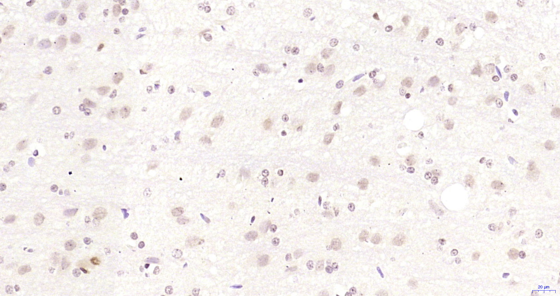 Paraformaldehyde-fixed, paraffin embedded Rat brain; Antigen retrieval by boiling in sodium citrate buffer (pH6.0) for 15min; Block endogenous peroxidase by 3% hydrogen peroxide for 20 minutes; Blocking buffer (normal goat serum) at 37°C for 30min; Antibody incubation with TOB Polyclonal Antibody, Unconjugated (bs-18164R) at 1:200 overnight at 4°C, DAB staining.