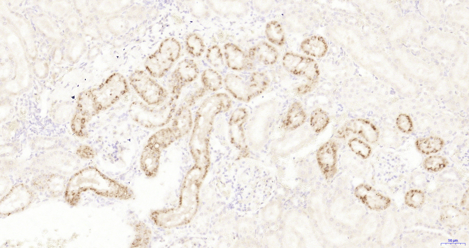 Paraformaldehyde-fixed, paraffin embedded Rat kidney; Antigen retrieval by boiling in sodium citrate buffer (pH6.0) for 15min; Block endogenous peroxidase by 3% hydrogen peroxide for 20 minutes; Blocking buffer (normal goat serum) at 37°C for 30min; Antibody incubation with LPHN1 Polyclonal Antibody, Unconjugated (bs-18348R) at 1:200 overnight at 4°C, DAB staining.