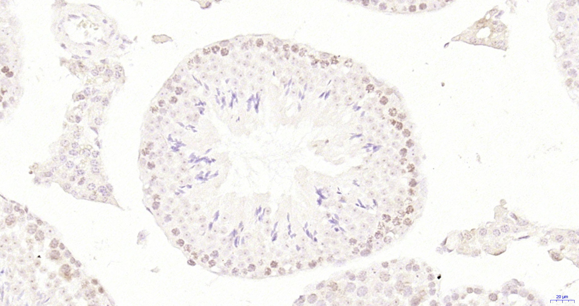 Paraformaldehyde-fixed, paraffin embedded Mouse testis; Antigen retrieval by boiling in sodium citrate buffer (pH6.0) for 15min; Block endogenous peroxidase by 3% hydrogen peroxide for 20 minutes; Blocking buffer (normal goat serum) at 37°C for 30min; Antibody incubation with LSM12 Polyclonal Antibody, Unconjugated (bs-18436R) at 1:200 overnight at 4°C, DAB staining.