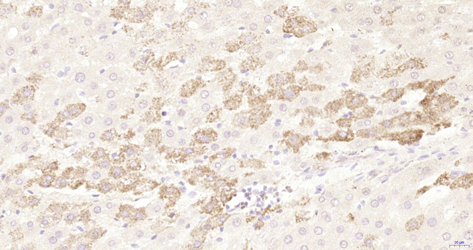 Paraformaldehyde-fixed, paraffin embedded Rat liver; Antigen retrieval by boiling in sodium citrate buffer (pH6.0) for 15min; Block endogenous peroxidase by 3% hydrogen peroxide for 20 minutes; Blocking buffer (normal goat serum) at 37°C for 30min; Antibody incubation with LSM12 Polyclonal Antibody, Unconjugated (bs-18436R) at 1:200 overnight at 4°C, DAB staining. Paraformaldehyde-fixed, paraffin embedded Rat liver; Antigen retrieval by boiling in sodium citrate buffer (pH6.0) for 15min; Block endogenous peroxidase by 3% hydrogen peroxide for 20 minutes; Blocking buffer (normal goat serum) at 37°C for 30min; Antibody incubation with LSM12 Polyclonal Antibody, Unconjugated (bs-18436R) at 1:200 overnight at 4°C, DAB staining.