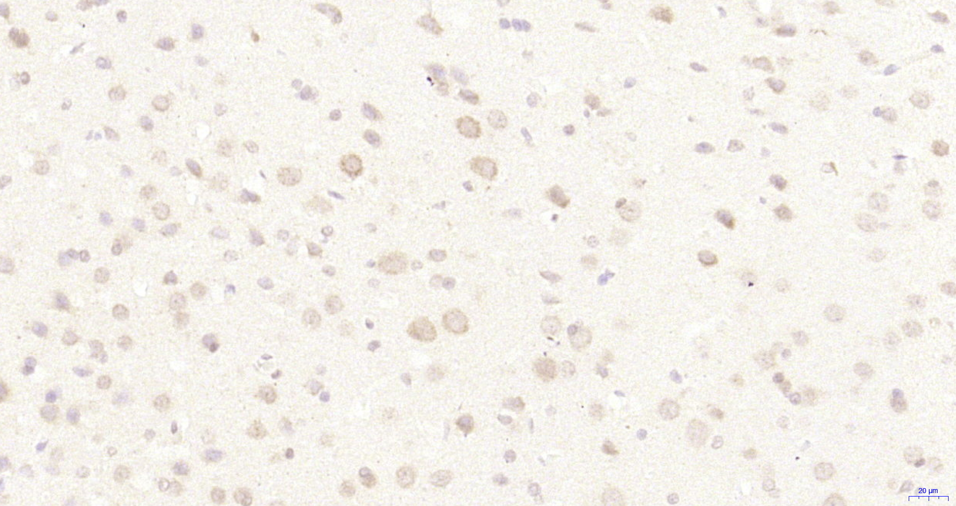 Paraformaldehyde-fixed, paraffin embedded Rat brain; Antigen retrieval by boiling in sodium citrate buffer (pH6.0) for 15min; Block endogenous peroxidase by 3% hydrogen peroxide for 20 minutes; Blocking buffer (normal goat serum) at 37°C for 30min; Antibody incubation with ZNF622 Polyclonal Antibody, Unconjugated (bs-18514R) at 1:200 overnight at 4°C, DAB staining.