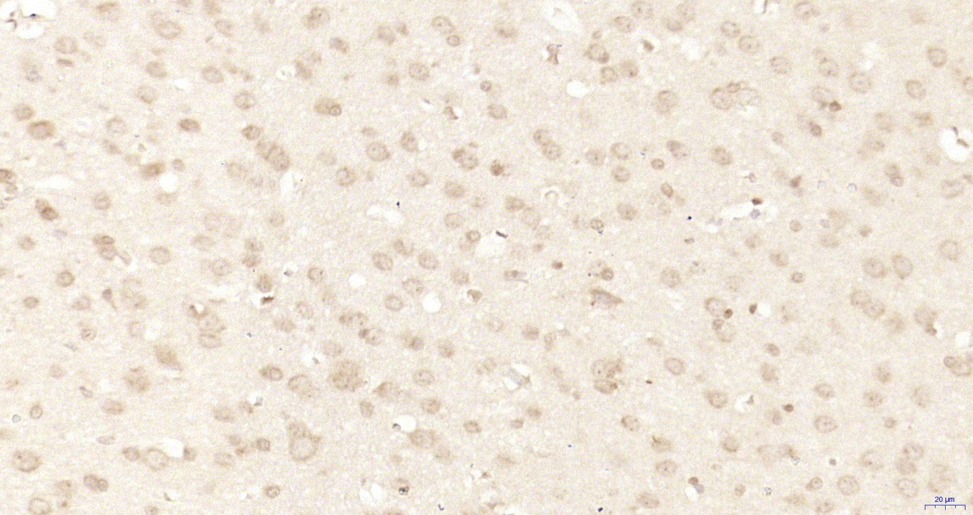 Paraformaldehyde-fixed, paraffin embedded Rat brain; Antigen retrieval by boiling in sodium citrate buffer (pH6.0) for 15min; Block endogenous peroxidase by 3% hydrogen peroxide for 20 minutes; Blocking buffer (normal goat serum) at 37°C for 30min; Antibody incubation with MAGOH/Mago nashi homolog 2 Polyclonal Antibody, Unconjugated (bs-18631R) at 1:200 overnight at 4°C, DAB staining.