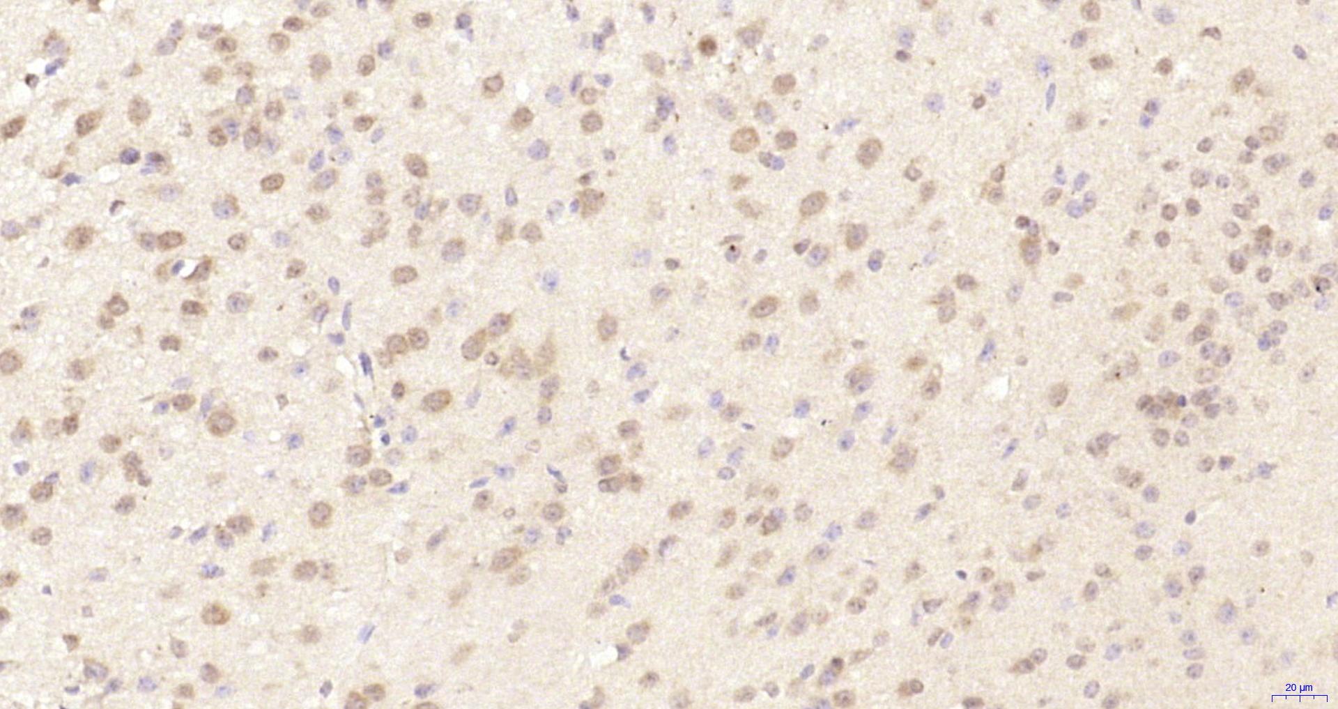 Paraformaldehyde-fixed, paraffin embedded Mouse brain; Antigen retrieval by boiling in sodium citrate buffer (pH6.0) for 15min; Block endogenous peroxidase by 3% hydrogen peroxide for 20 minutes; Blocking buffer (normal goat serum) at 37°C for 30min; Antibody incubation with MAGOH/Mago nashi homolog 2 Polyclonal Antibody, Unconjugated (bs-18631R) at 1:200 overnight at 4°C, DAB staining. Paraformaldehyde-fixed, paraffin embedded Mouse brain; Antigen retrieval by boiling in sodium citrate buffer (pH6.0) for 15min; Block endogenous peroxidase by 3% hydrogen peroxide for 20 minutes; Blocking buffer (normal goat serum) at 37°C for 30min; Antibody incubation with MAGOH/Mago nashi homolog 2 Polyclonal Antibody, Unconjugated (bs-18631R) at 1:200 overnight at 4°C, DAB staining.