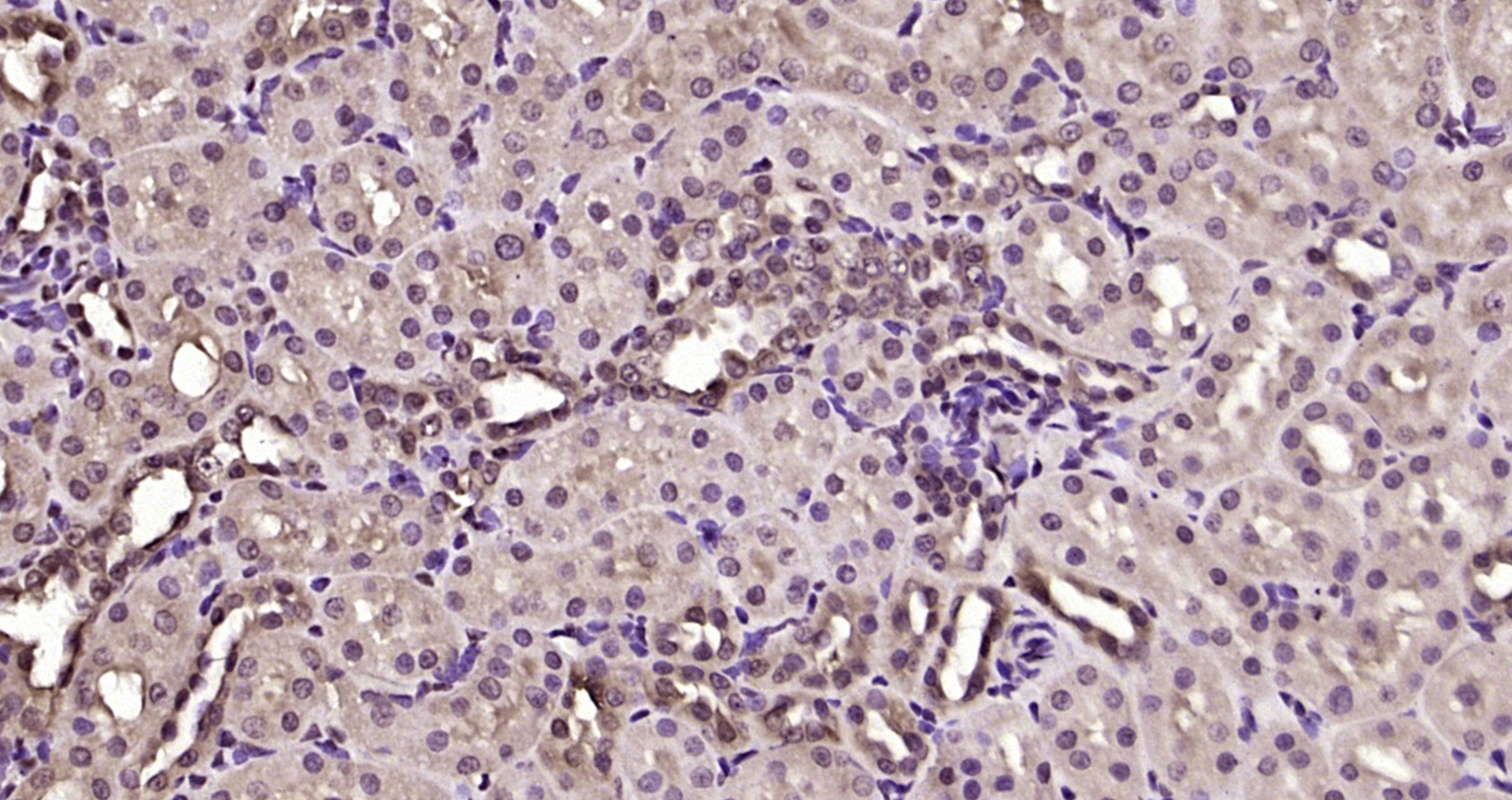 Paraformaldehyde-fixed, paraffin embedded Rat kidney; Antigen retrieval by boiling in sodium citrate buffer (pH6.0) for 15min; Block endogenous peroxidase by 3% hydrogen peroxide for 20 minutes; Blocking buffer (normal goat serum) at 37°C for 30min; Antibody incubation with MED19/LCMR1 Polyclonal Antibody, Unconjugated (bs-18765R) at 1:200 overnight at 4°C, DAB staining.