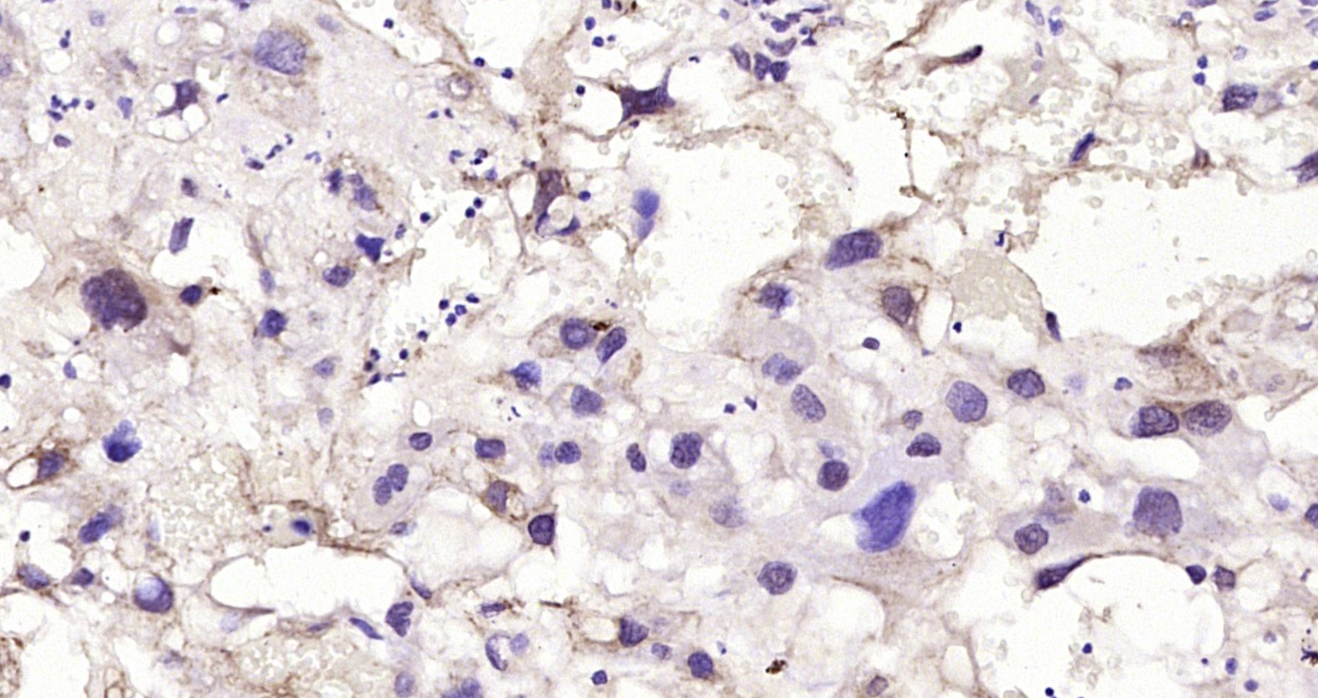 Paraformaldehyde-fixed, paraffin embedded Rat placenta; Antigen retrieval by boiling in sodium citrate buffer (pH6.0) for 15min; Block endogenous peroxidase by 3% hydrogen peroxide for 20 minutes; Blocking buffer (normal goat serum) at 37°C for 30min; Antibody incubation with phospho-MEK7 (Thr275) Polyclonal Antibody, Unconjugated (bs-18779R) at 1:200 overnight at 4°C, DAB staining.