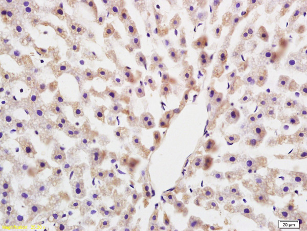 Formalin-fixed and paraffin embedded rat liver labeled with Anti COLEC10(LIVER) Polyclonal Antibody, Unconjugated (bs-8033R) at 1:200 followed by conjugation to the secondary antibody and DAB staining