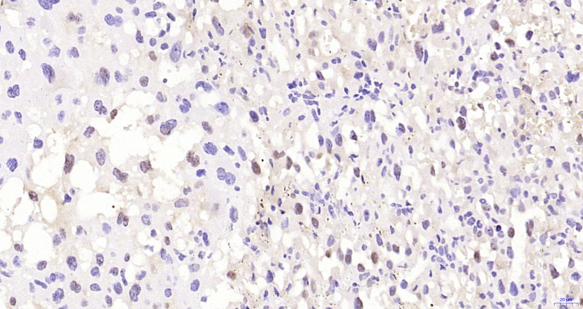 Paraformaldehyde-fixed, paraffin embedded Mouse placenta; Antigen retrieval by boiling in sodium citrate buffer (pH6.0) for 15min; Block endogenous peroxidase by 3% hydrogen peroxide for 20 minutes; Blocking buffer (normal goat serum) at 37°C for 30min; Antibody incubation with NCBP1 Polyclonal Antibody, Unconjugated (bs-19043R) at 1:200 overnight at 4°C, DAB staining.