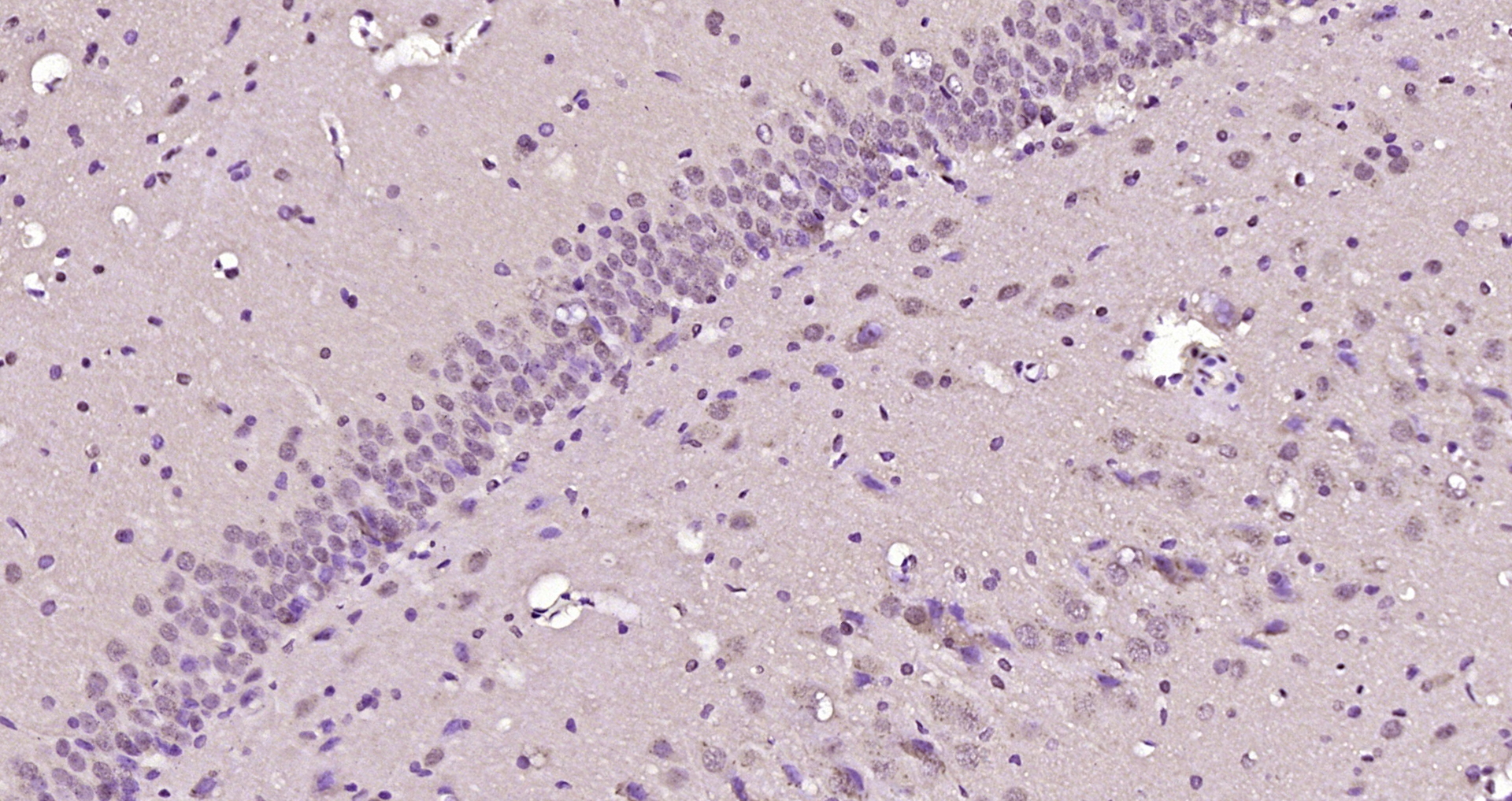 Paraformaldehyde-fixed, paraffin embedded Rat brain; Antigen retrieval by boiling in sodium citrate buffer (pH6.0) for 15min; Block endogenous peroxidase by 3% hydrogen peroxide for 20 minutes; Blocking buffer (normal goat serum) at 37°C for 30min; Antibody incubation with RBMXL1 Polyclonal Antibody, Unconjugated (bs-19778R) at 1:200 overnight at 4°C, DAB staining.