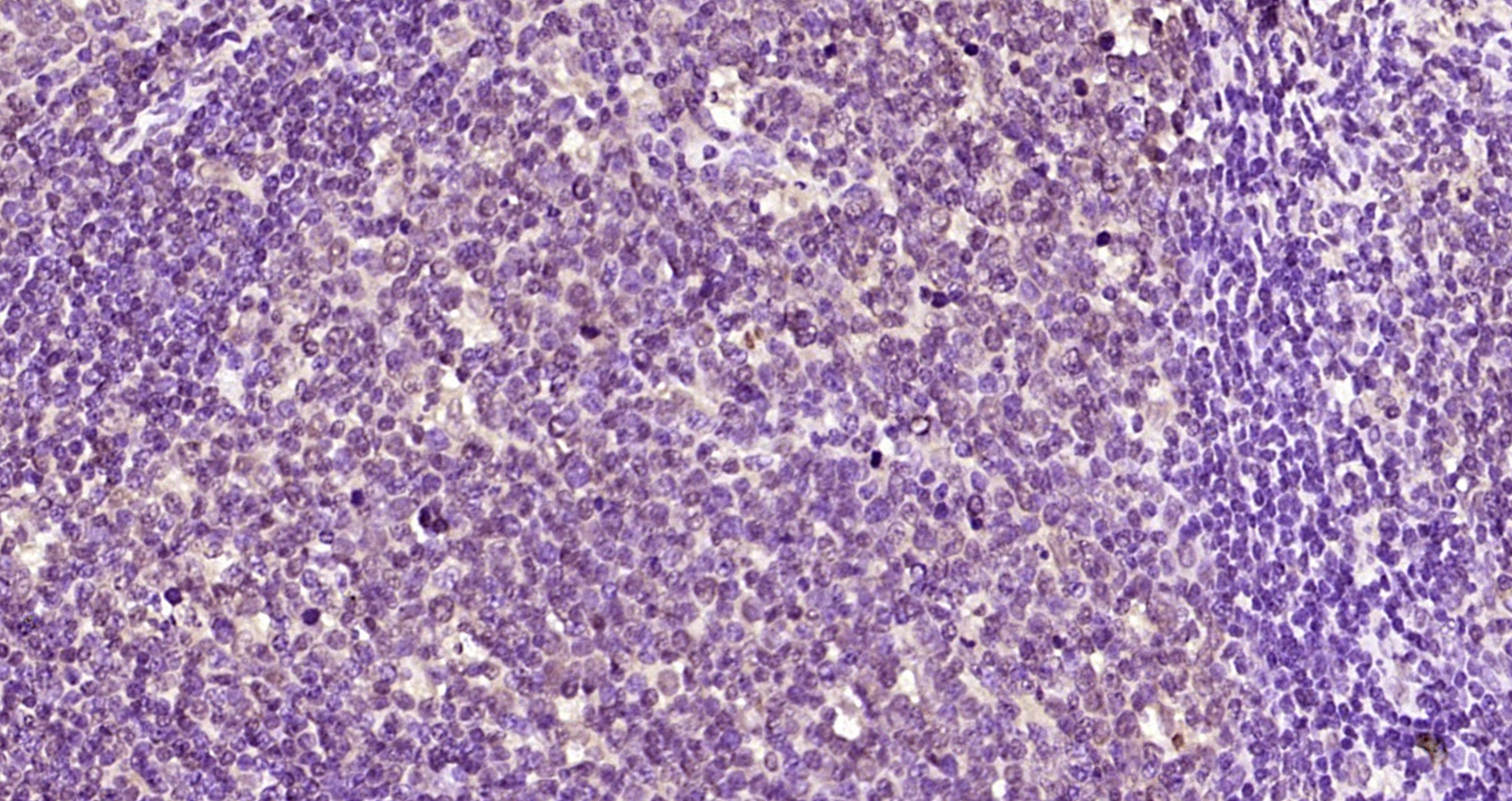Paraformaldehyde-fixed, paraffin embedded Human tonsil; Antigen retrieval by boiling in sodium citrate buffer (pH6.0) for 15min; Block endogenous peroxidase by 3% hydrogen peroxide for 20 minutes; Blocking buffer (normal goat serum) at 37°C for 30min; Antibody incubation with p45 NF-E2 Polyclonal Antibody, Unconjugated (bs-22023R) at 1:200 overnight at 4°C, DAB staining.