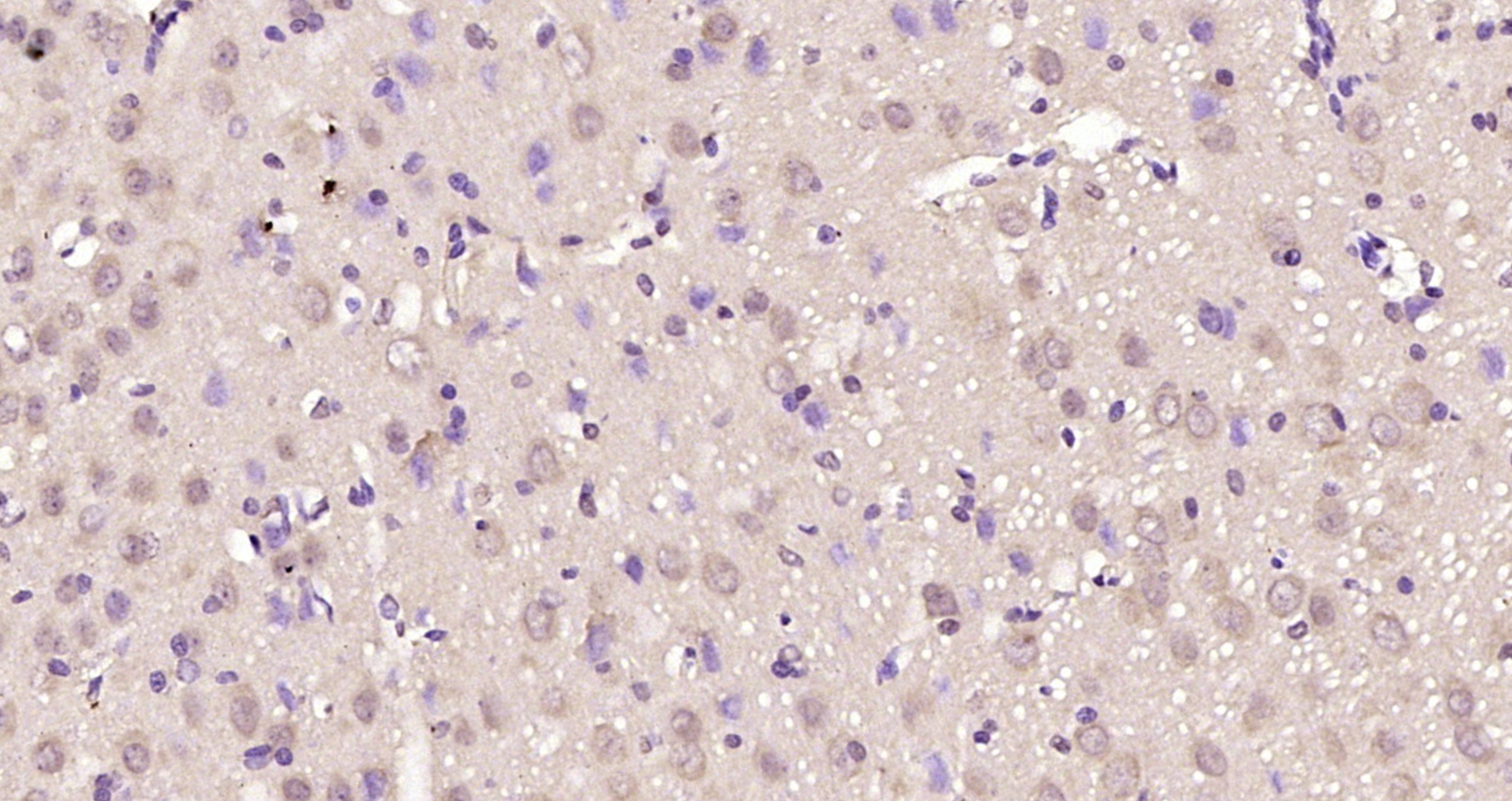 Paraformaldehyde-fixed, paraffin embedded Rat brain; Antigen retrieval by boiling in sodium citrate buffer (pH6.0) for 15min; Block endogenous peroxidase by 3% hydrogen peroxide for 20 minutes; Blocking buffer (normal goat serum) at 37°C for 30min; Antibody incubation with MeCP2 Polyclonal Antibody, Unconjugated (bs-22098R) at 1:200 overnight at 4°C, DAB staining.