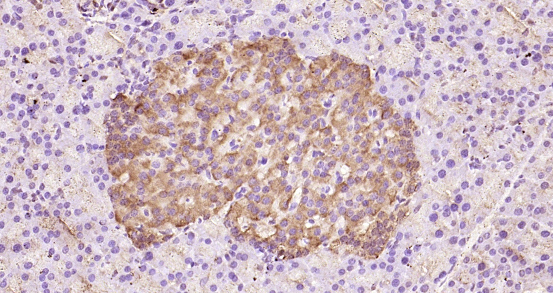 Paraformaldehyde-fixed, paraffin embedded Rat pancreas; Antigen retrieval by boiling in sodium citrate buffer (pH6.0) for 15min; Block endogenous peroxidase by 3% hydrogen peroxide for 20 minutes; Blocking buffer (normal goat serum) at 37°C for 30min; Antibody incubation with C Peptide (mouse) Polyclonal Antibody, Unconjugated (bs-23205R) at 1:200 overnight at 4°C, DAB staining.