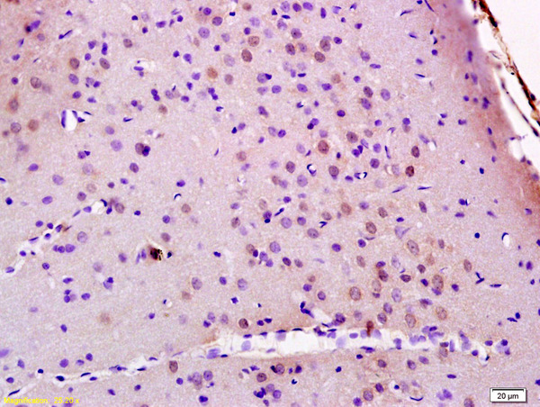 Formalin-fixed and paraffin embedded rat brain labeled with Anti JMY Polyclonal Antibody, Unconjugated (bs-7614R) at 1:200 followed by conjugation to the secondary antibody and DAB staining