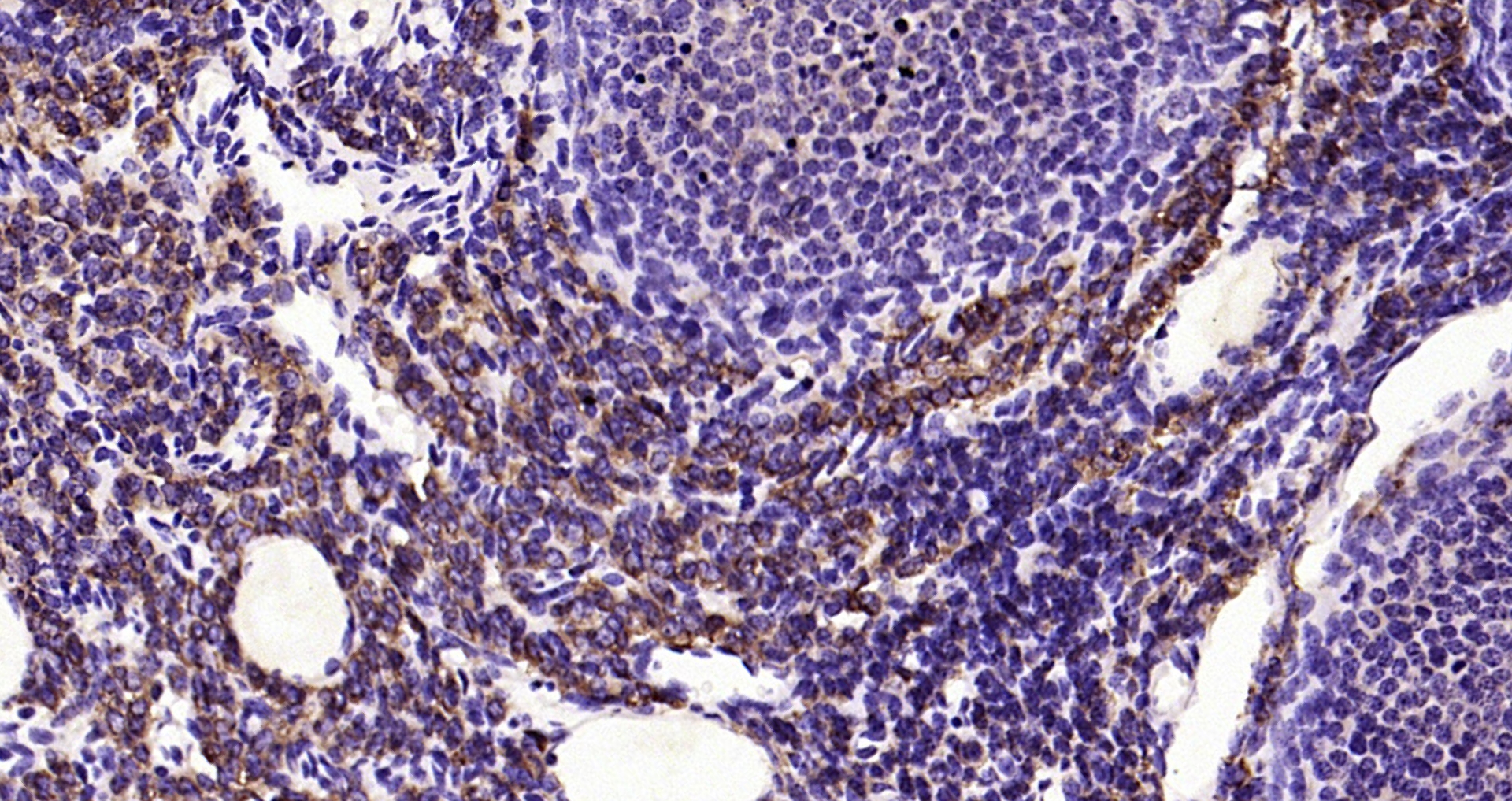 Paraformaldehyde-fixed, paraffin embedded Rat ovarian; Antigen retrieval by boiling in sodium citrate buffer (pH6.0) for 15min; Block endogenous peroxidase by 3% hydrogen peroxide for 20 minutes; Blocking buffer (normal goat serum) at 37°C for 30min; Antibody incubation with ACE2 Polyclonal Antibody, Unconjugated (bs-41410R) at 1:200 overnight at 4°C, DAB staining.