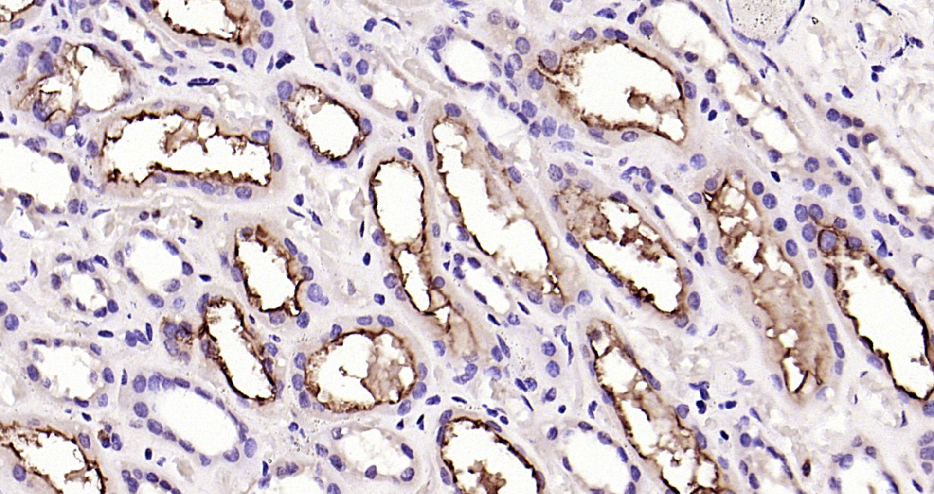 Paraformaldehyde-fixed, paraffin embedded Human kidney; Antigen retrieval by boiling in sodium citrate buffer (pH6.0) for 15min; Block endogenous peroxidase by 3% hydrogen peroxide for 20 minutes; Blocking buffer (normal goat serum) at 37°C for 30min; Antibody incubation with ACE2 Polyclonal Antibody, Unconjugated (bs-41410R) at 1:200 overnight at 4°C, DAB staining.