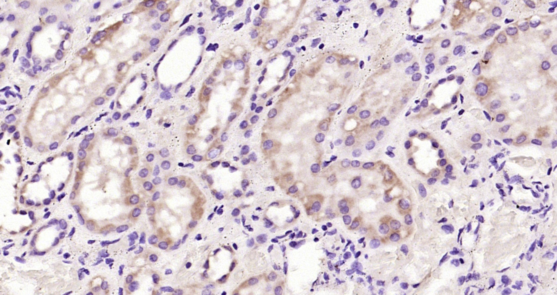 Paraformaldehyde-fixed, paraffin embedded Human kidney; Antigen retrieval by boiling in sodium citrate buffer (pH6.0) for 15min; Block endogenous peroxidase by 3% hydrogen peroxide for 20 minutes; Blocking buffer (normal goat serum) at 37°C for 30min; Antibody incubation with VEGF Monoclonal Antibody, Unconjugated (bsm-10855M) at 1:200 overnight at 4°C, DAB staining.